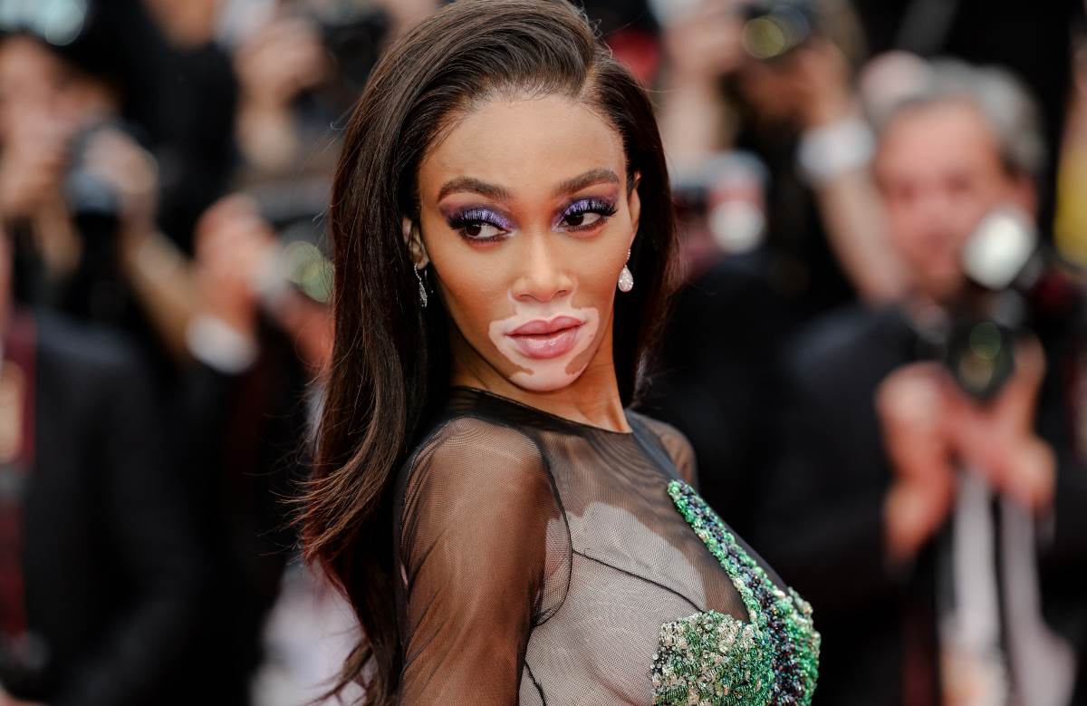 Winnie Harlow